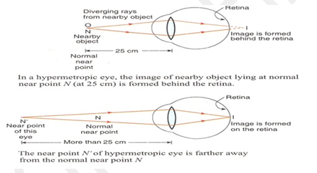 UKPCS Science: Human Eye(3) #31 | ORACLE IAS